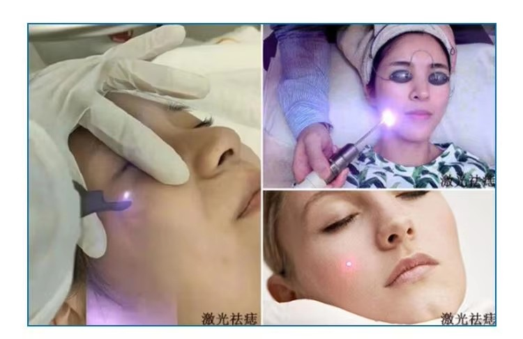 850nm 1W laser module